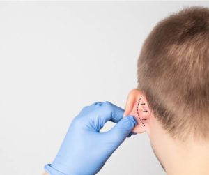 plastic surgeon doctor examines a male patient s ear for an otoplasty