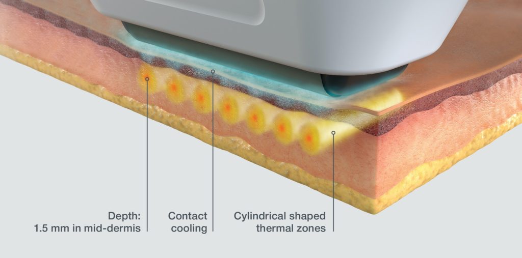 diagram showing the skin