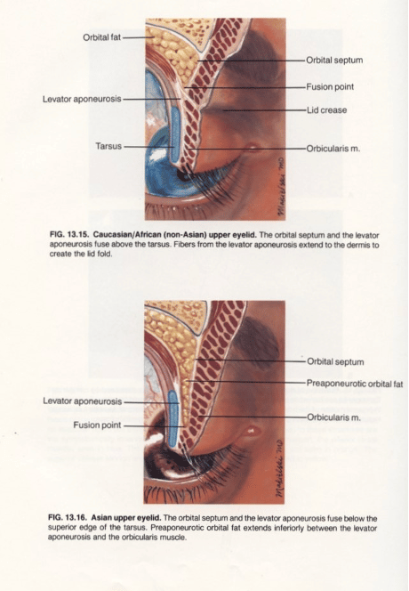 Eyelid surgery